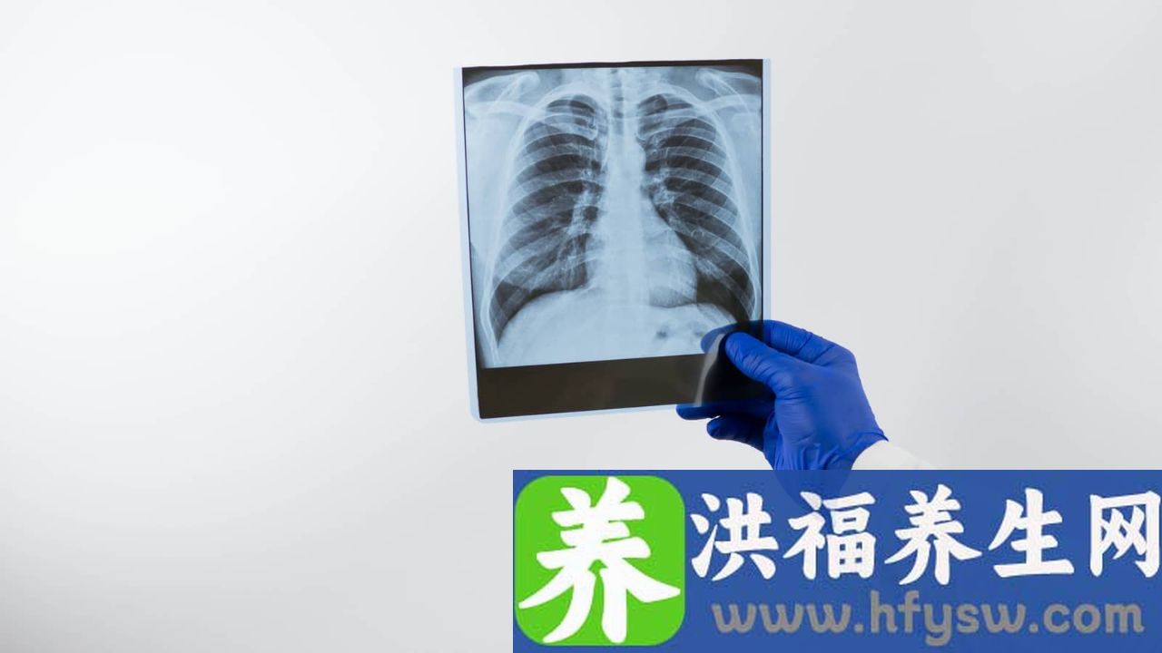 支原体肺炎是否有白肺