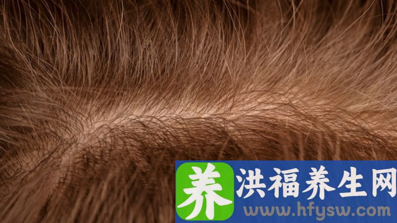 男性头顶疼的原因是什么
