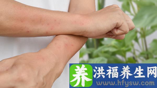 一型疱疹HSV弱阳性