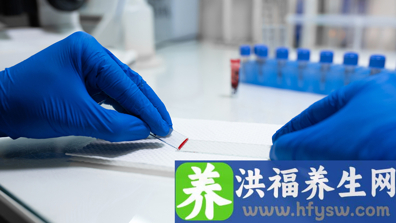 缺铁性贫血能喝酸奶吗