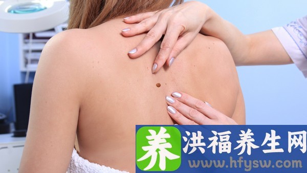 得了生殖器疱疹没药怎么办