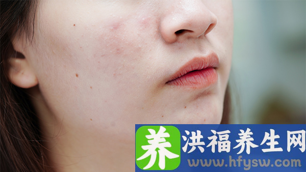 脸部神经疼痛的治疗