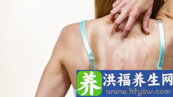 血小板紫癜会引起白血病吗