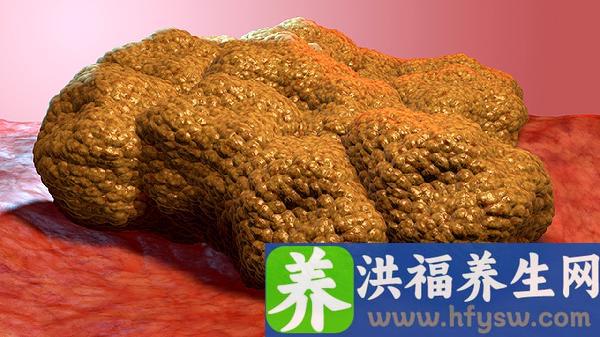 老年肿瘤患者迎来新希望