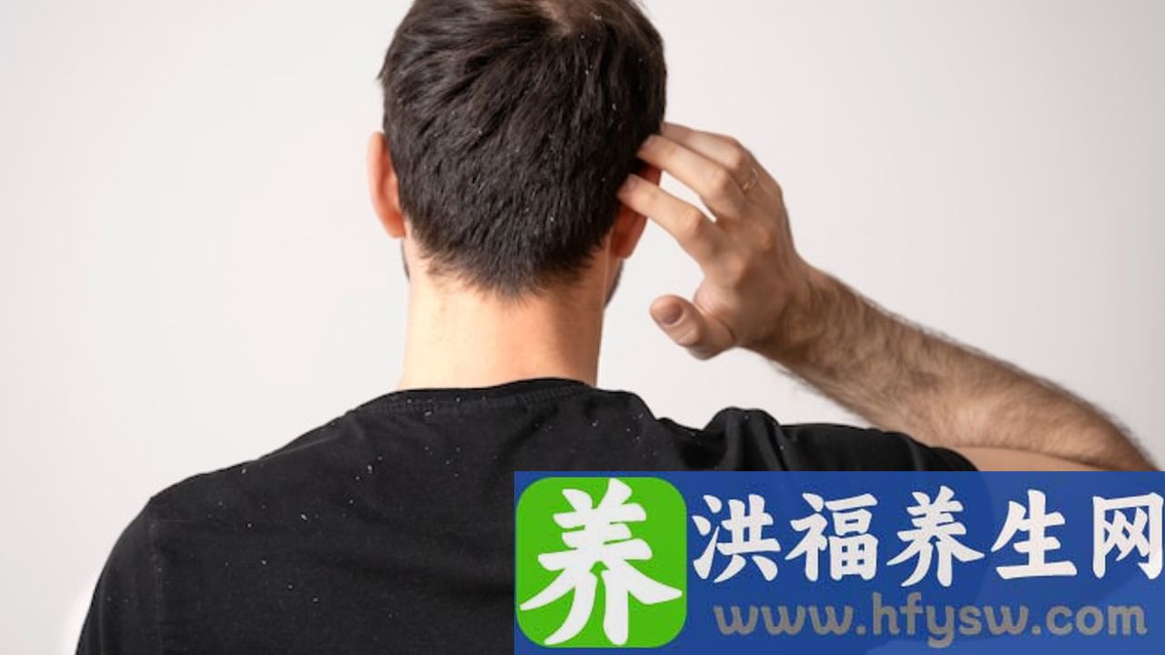 头皮一阵一阵发麻是什么原因