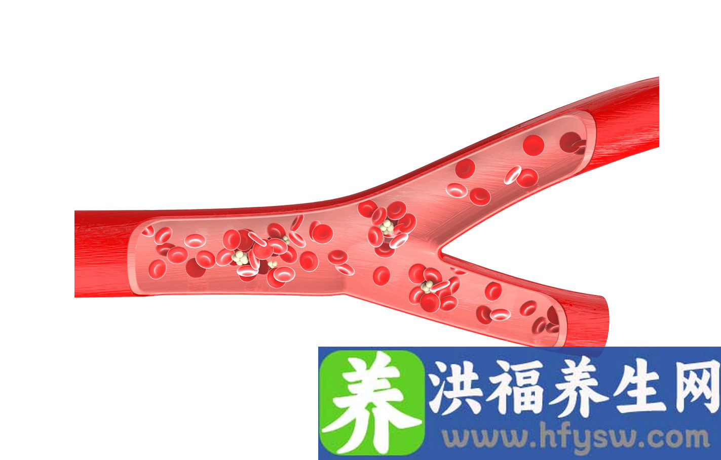 风湿性血管炎能治好吗