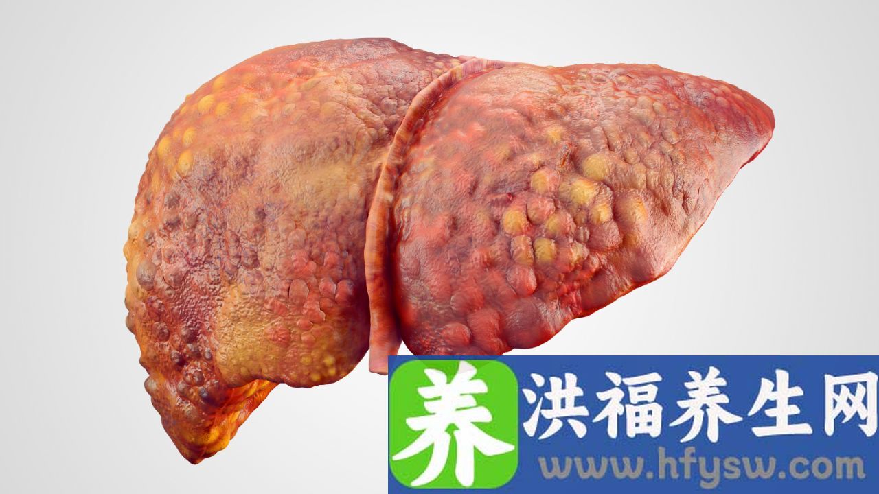 肝硬化的原因是什么