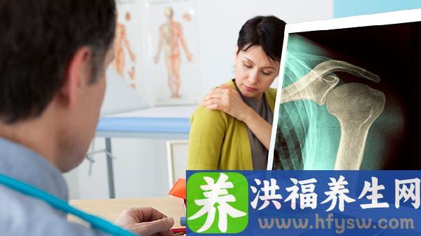血小板50-60要做骨髓穿刺吗