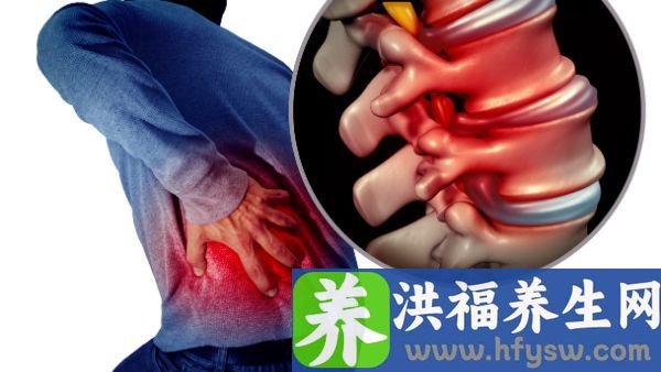 腰椎疼痛压迫神经腿疼怎么治