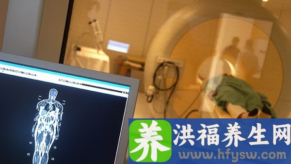 检查精子畸形需要查啥呀