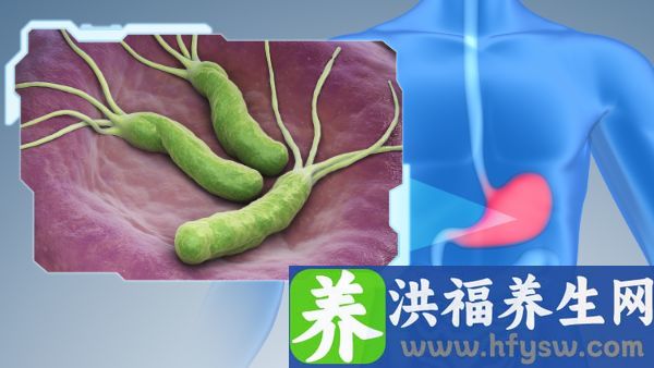 幽门螺杆菌1700会癌变吗