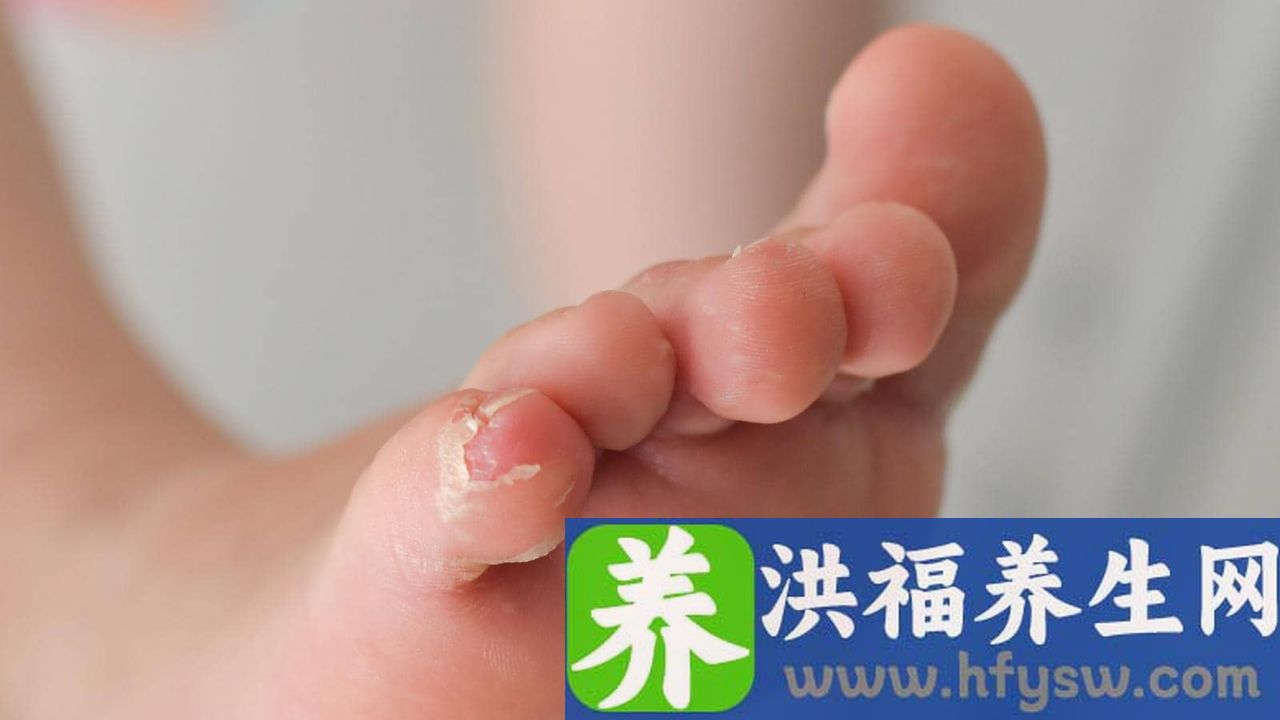 左脚左手麻木是什么原因