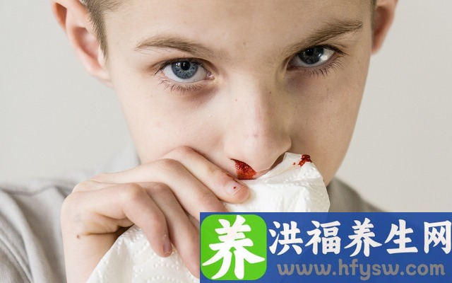 孩子经常流鼻血是什么原因造成的？如何做好预防措施？