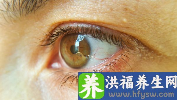 眼球震颤的病因有哪些