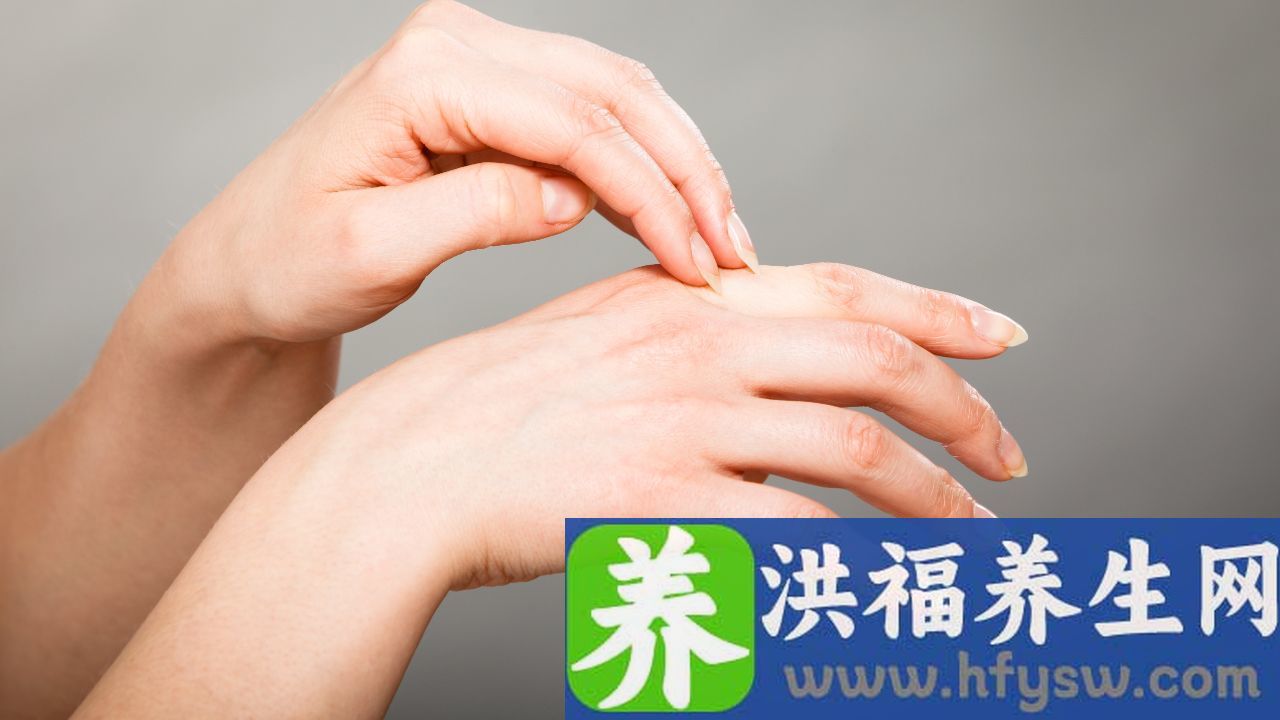 风湿性关节炎会起皮疹吗