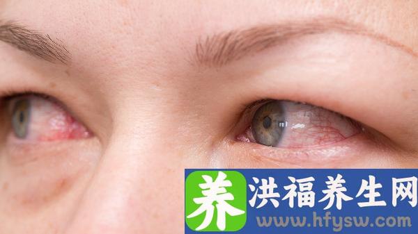 做上睑提肌矫正上睑下垂手术大概需要多少钱？
