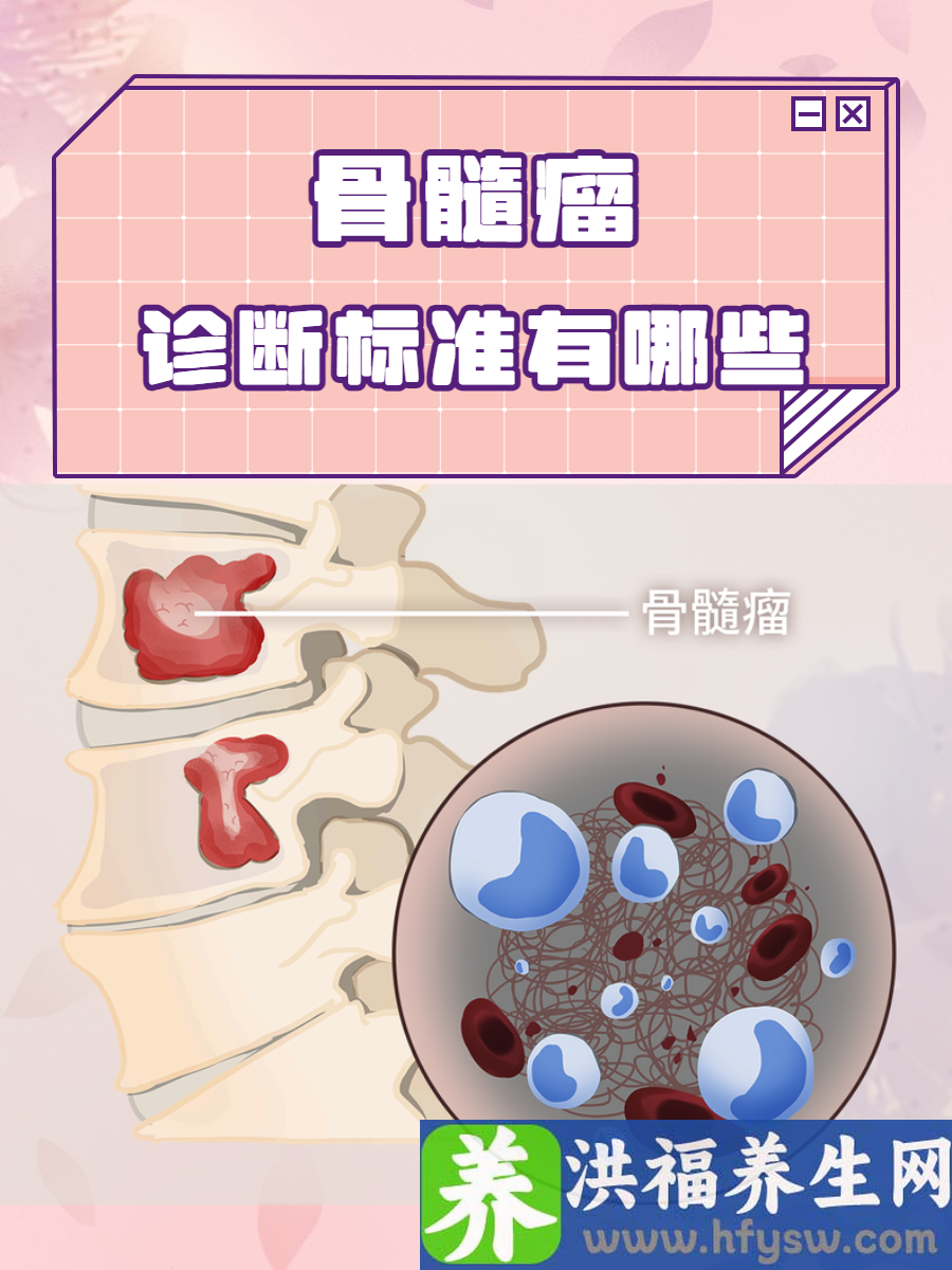 骨髓瘤诊断标准有哪些？这些标准你想到了吗