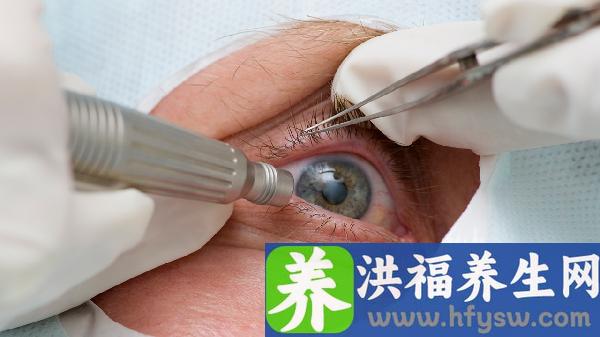 白内障手术一年后眼睛干涩