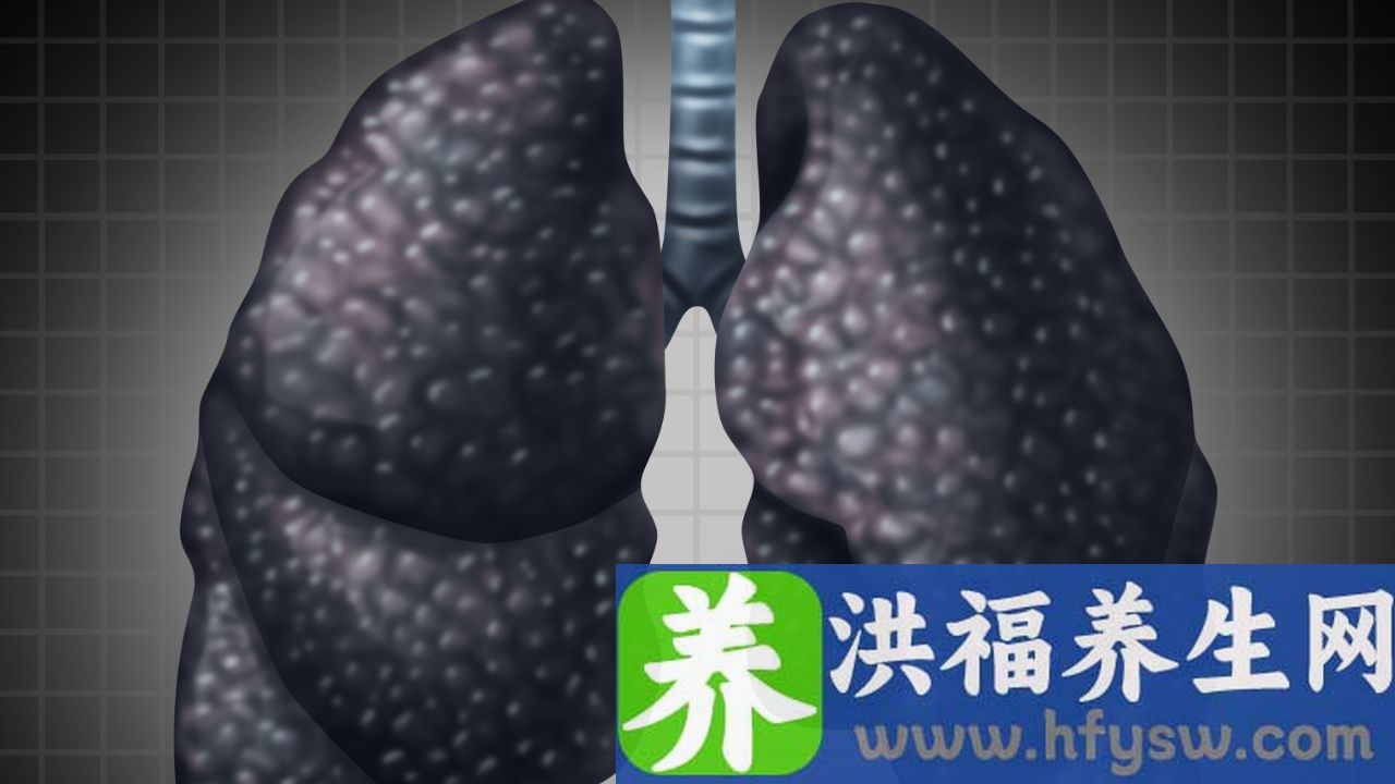 肺部微小结节是什么意思