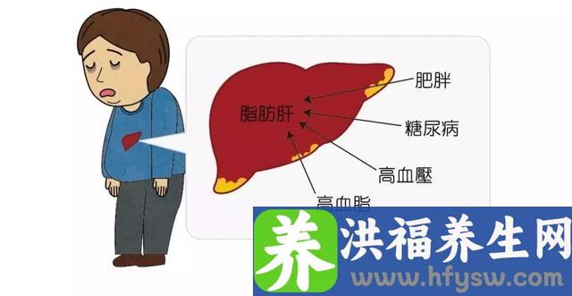 脂肪肝最“怕”这10种食物，经常吃一吃，肝一天比一天好
