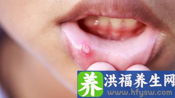 上火了淋巴结肿大疼痛怎么回事