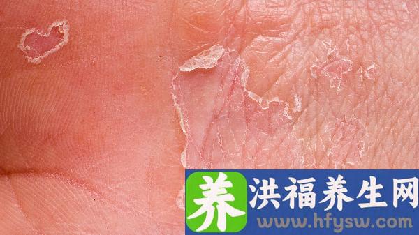 胼胝体发育不良四维能看出来吗