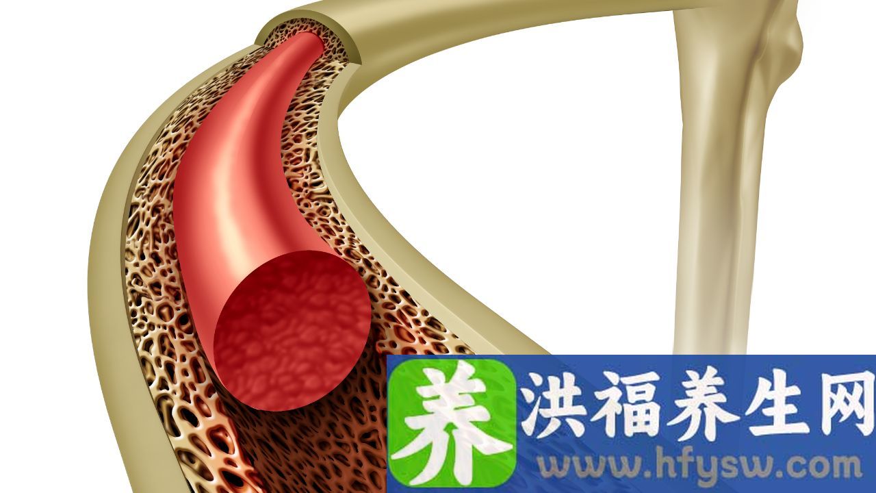 骨髓移植的注意事项有什么
