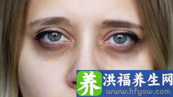 面神经麻痹怎么回事