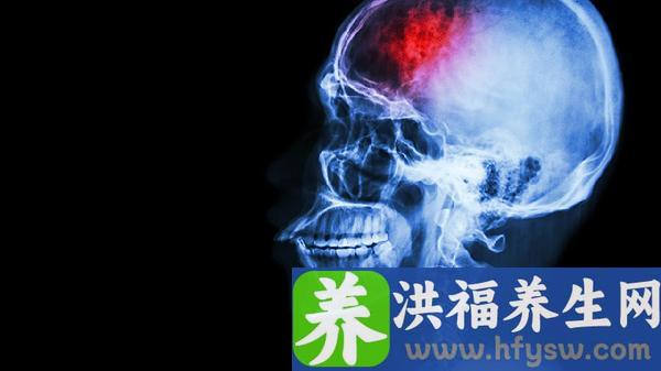 创伤性颅脑损伤是什么伤