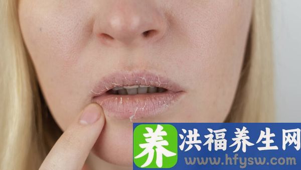 睡醒觉口苦口干是什么原因