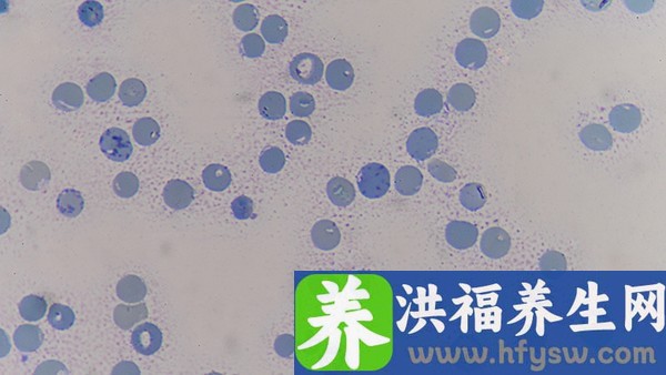 正清风痛宁缓释片能和抗病毒口服液一起吃吗 正清风痛宁缓释片不能和什么药一起用？