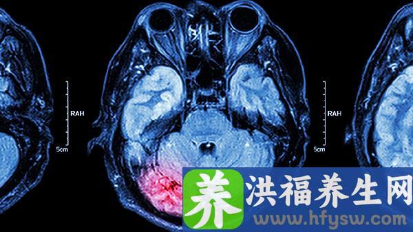 肾上腺肿瘤切除后多久恢复好