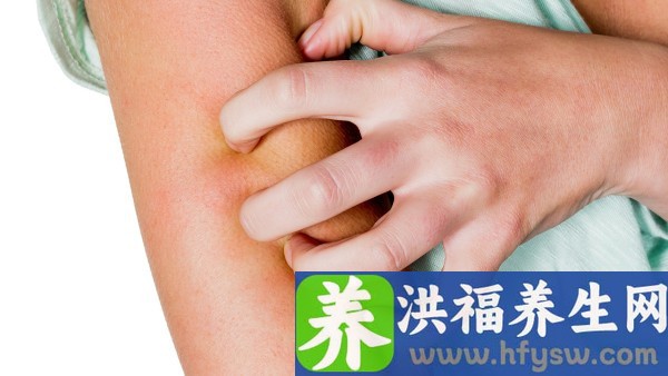 急性前列腺炎要查什么