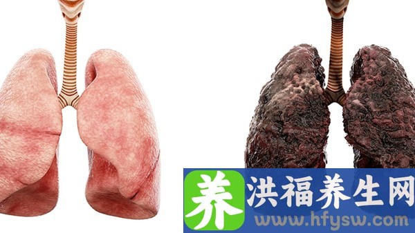 雷丸片哪个品牌的疗效最好 雷丸片哪里可以买到
