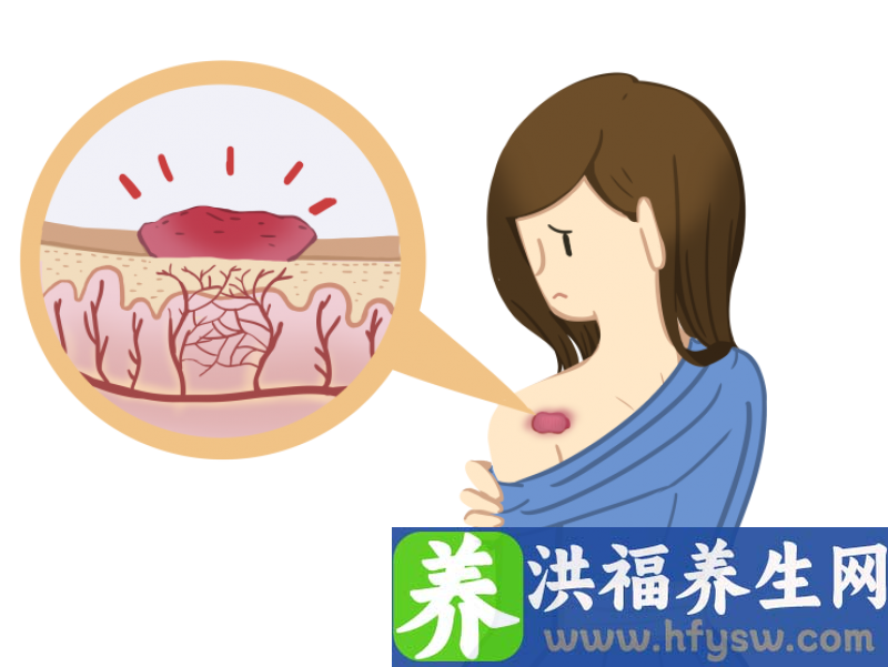 美容手术会不会留疤？疤痕高发部位尤其要谨慎