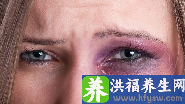 滴虫性阴道炎的症状有哪些？预防滴虫性阴道炎注意这7点