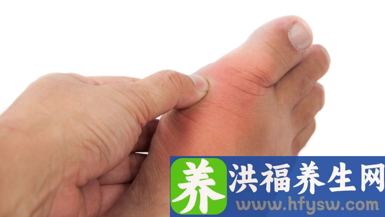 痛风吃双氯芬酸钠缓释片有用吗