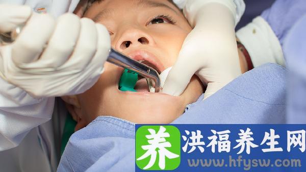 龅牙矫正一般维持多长时间？