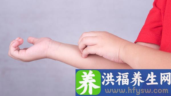 带状疱疹性咽峡炎的症状表现