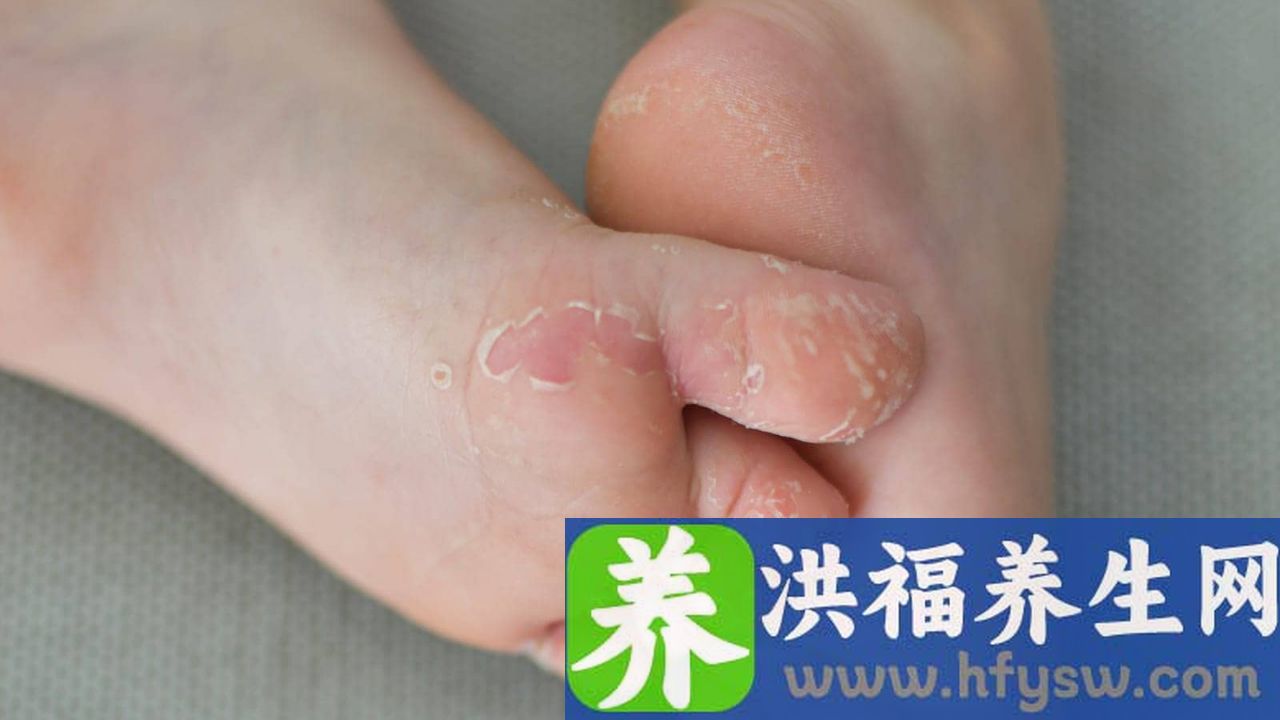 为什么脚手会麻木