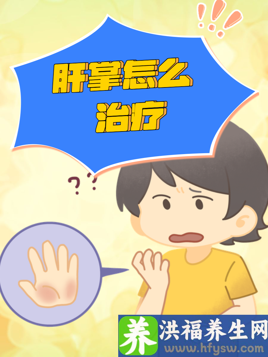 肝掌怎么治疗？教你摆脱肝掌的方法