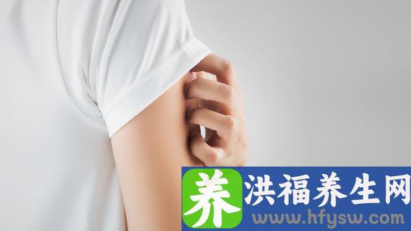 特发性血小板减少性紫癜的病因
