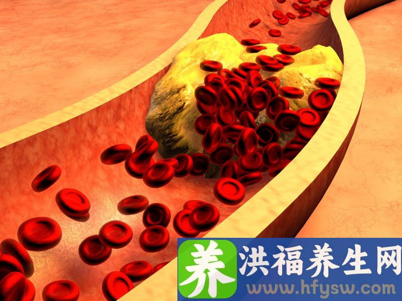 这4种常见食物，有助于清除血液中的废物，可以适量吃