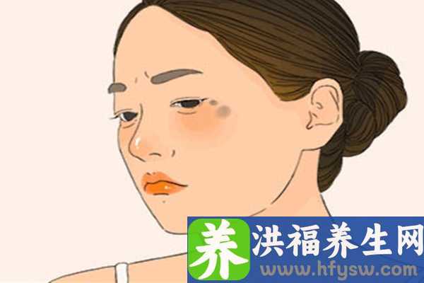脸上起老年斑怎样去除