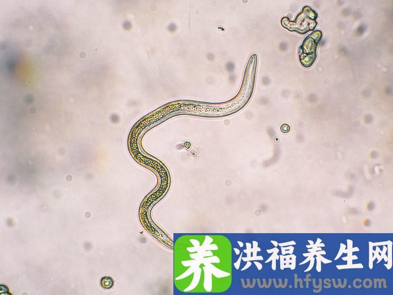 蛔虫性肠梗阻的病因