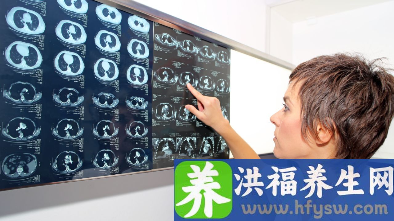 什么是肺部CT