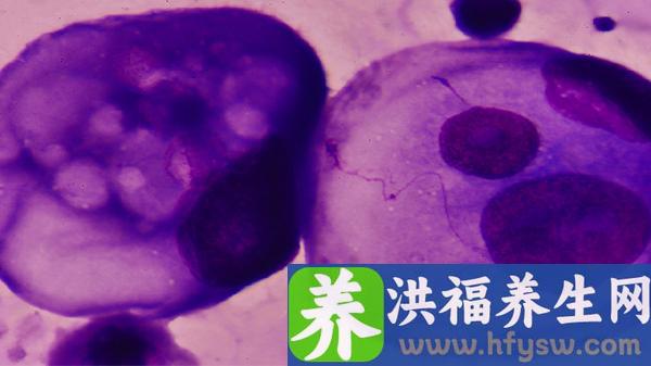 肿瘤在b超里是什么样子的