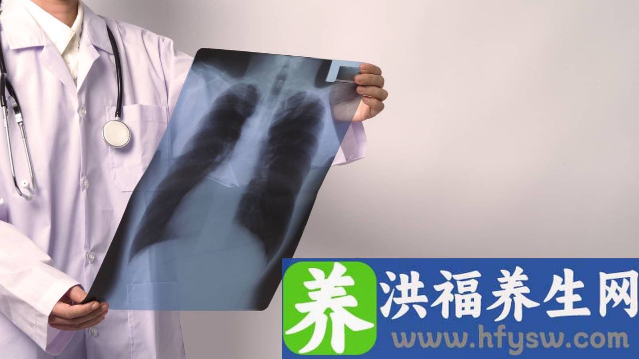 肺结节的症状有哪些症状表现