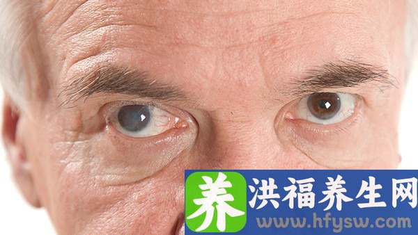 男性尖锐湿疣复发了吗？还是这是假性
