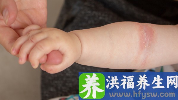 通宣理肺丸的功效与作用 通宣理肺丸是抗病毒的药吗